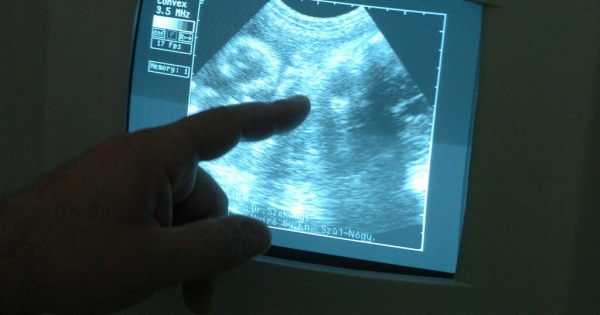 Emberi reprodukciós eljárások – a munkajogi háttér