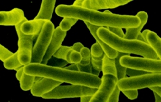 Már négy tbc-s beteget azonosítottak egy ceglédi gyárban