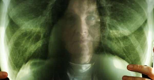 Egészségkárosodás esetén ilyenkor jogosult baleseti járadékra