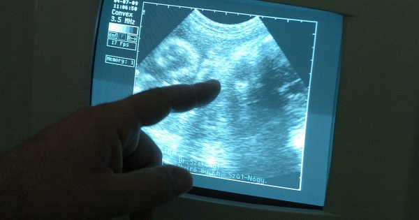 Lombikbébiprogram: így védi a törvény a munkavállalókat, kockázatos titkolózni