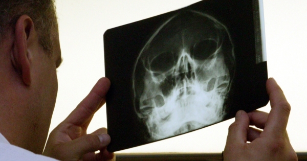 Üzemi baleset, foglalkozási betegségi után ilyen ellátást kaphat